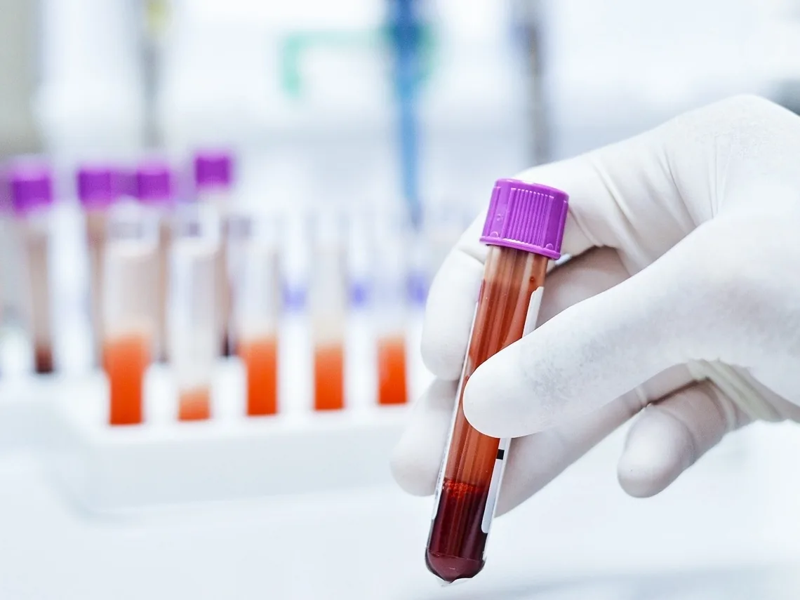 Tubo de coleta de sangue para investigação hematológica