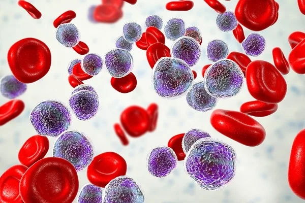 Microscopia de leucócitos e hemácias na investigação de leucemias