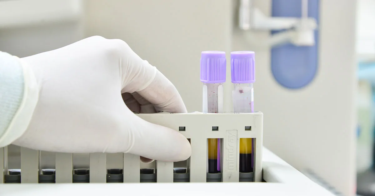 Tubos de coleta para hemograma